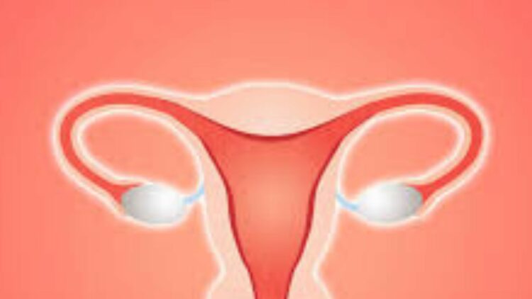 PMOS Officially Replaces PCOS: New PMOS Name Marks Historic Shift for Polycystic Ovary Syndrome Awareness, Diagnosis, Symptoms and Women’s Health